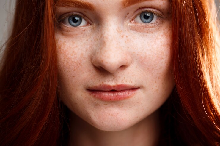 Decoding Ruddy Skin: 10 Reasons Behind Facial Redness